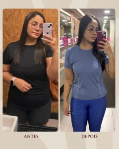 antes-e-depois-nucleo-lume-4